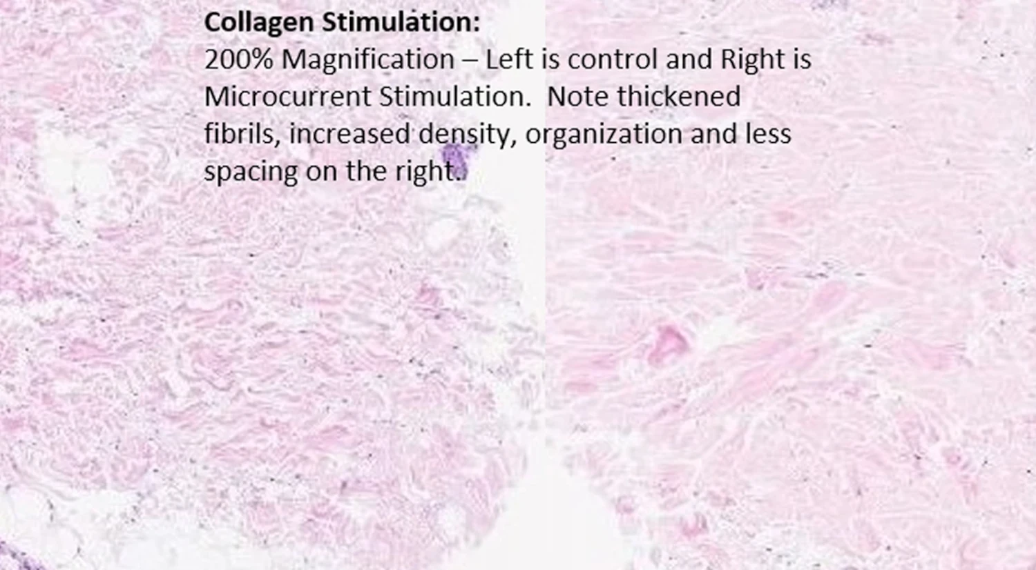 Microcurrent stimulation collagen production comparison diagram by Ion Sportswear.